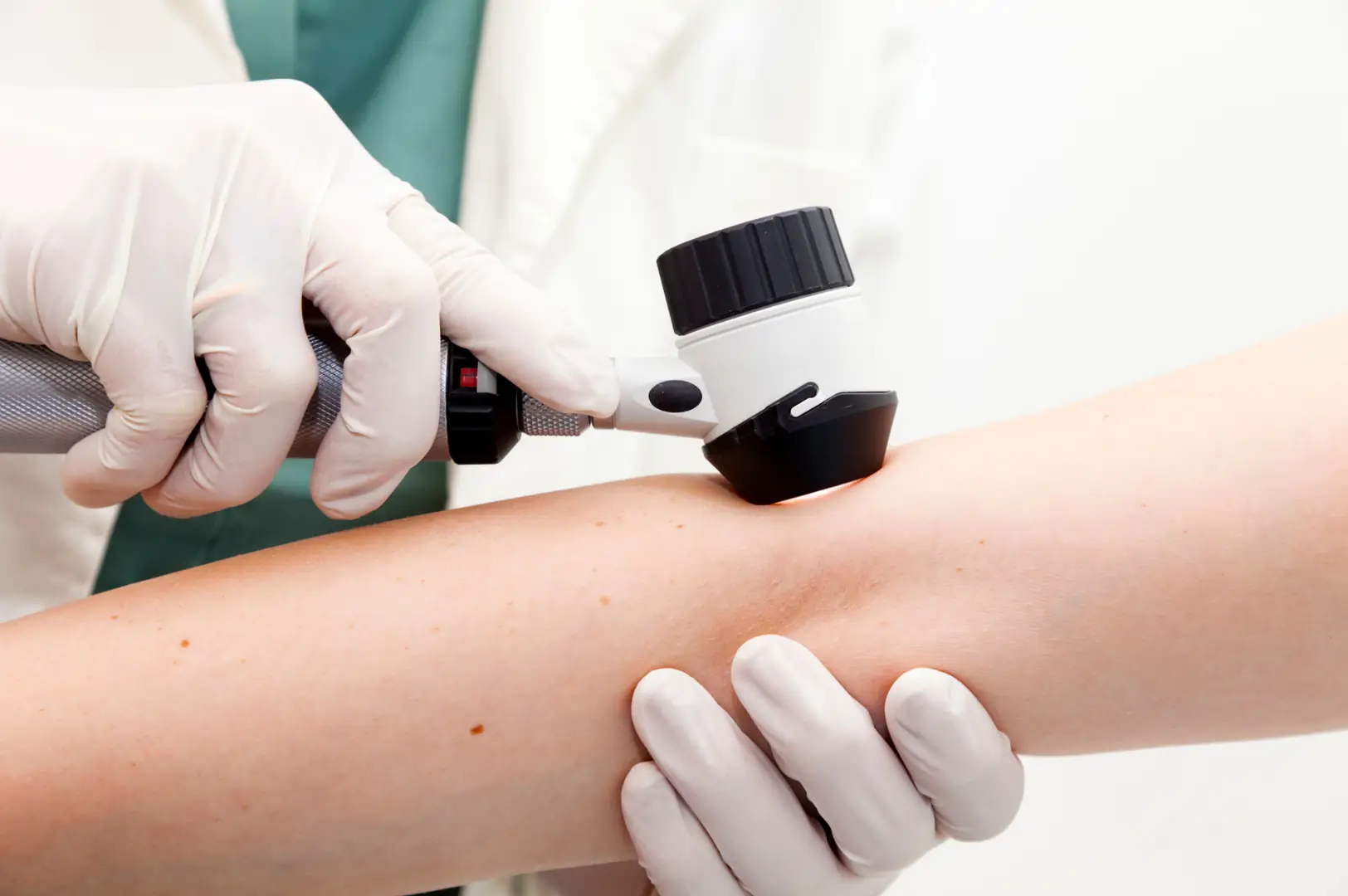 A dermatoscope, the tool used in dermoscopy at Clarion.