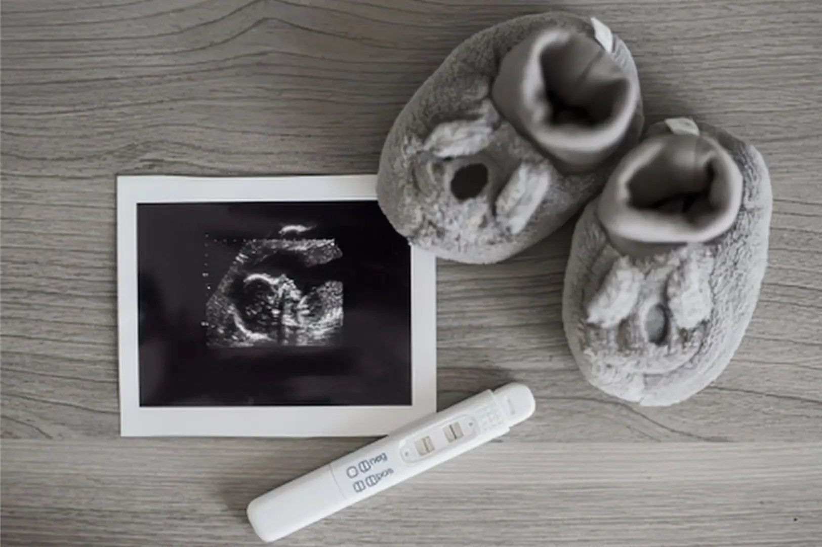 Ultrasound equipment ready in a consulting room at an SMSG centre.